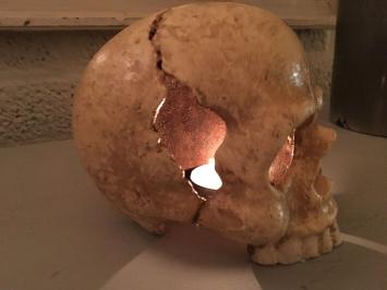 1 anatomische schedel, uit gietijzer-white-rust